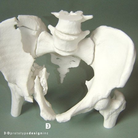 3d-printed-bone-medical-model-logo
